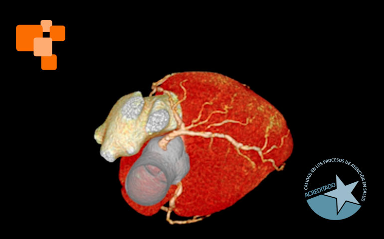 Exámenes de imagenología en Santa Cruz